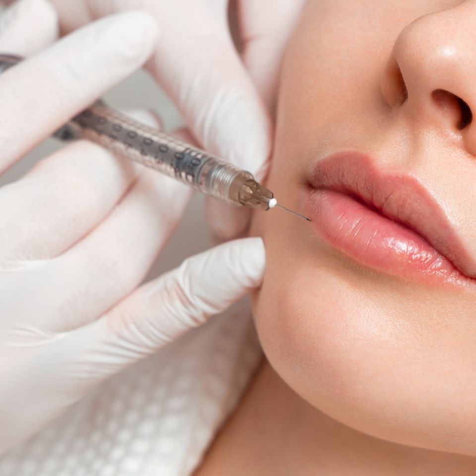 woman having lip fillers carried out by Nottingham Aesthetics company