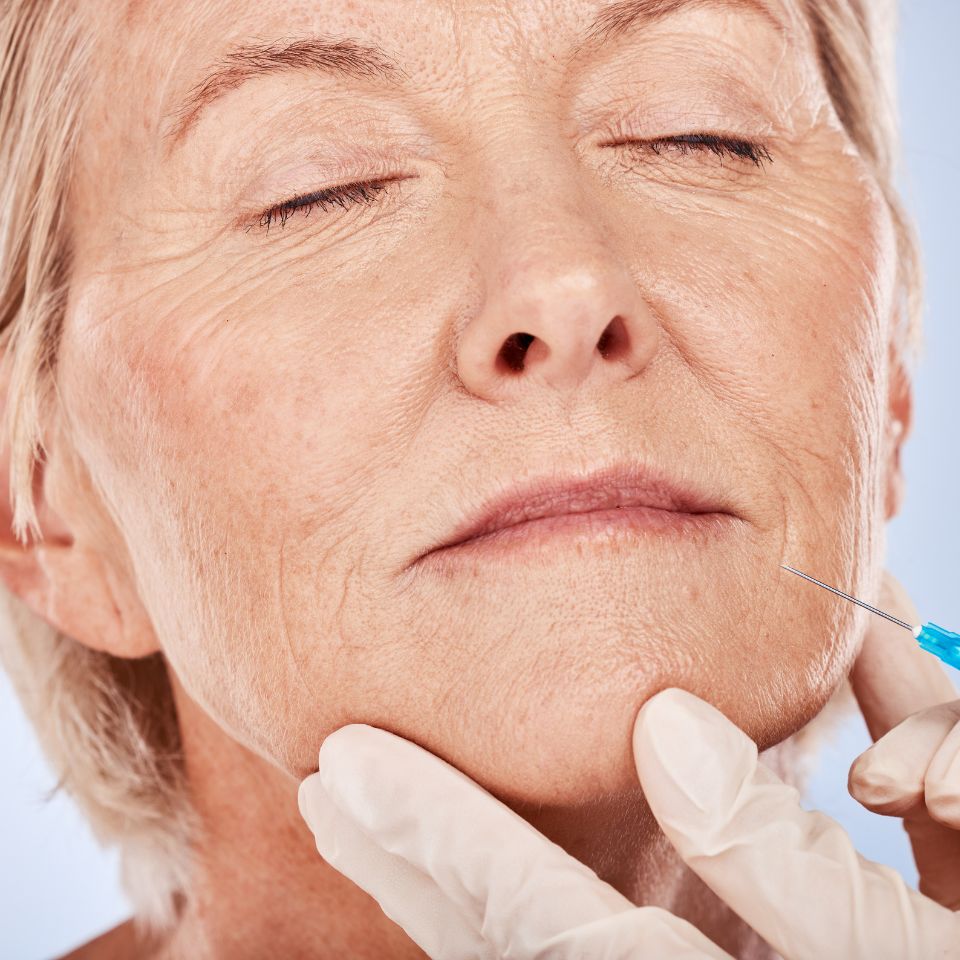 woman having botox treatment carried out by Nottingham Aesthetics company