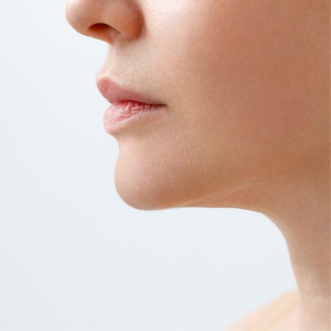 after photo showing a woman's non-surgical cosmetic treatment on face and jowl